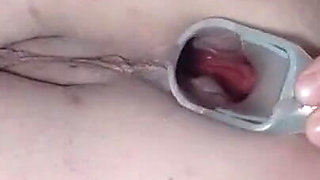 Panty speculum close ups of amazing bbw ass