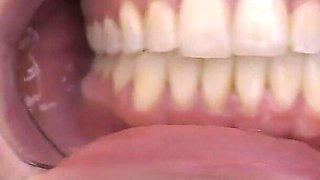 Glasses & Gape: 11-min Dental Speculum-stretched Drool Session