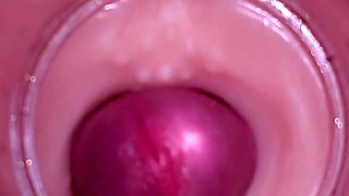 Female Insemination - Internal Camera Captures Deep Male Ejaculation