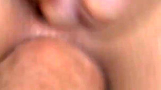 Doctors fucked in the ass by patient