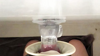 Dental Gag 2