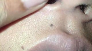 Nose pulling Twisting pinching, Requested video Funny video