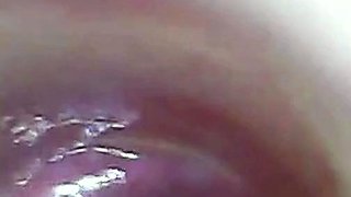 Endoscope POV: Test Tube Cock Urethral Insertion