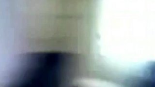 Hairy Webcam Girl in Wheelchair Shows Off