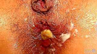 Amateur Anal Creampie