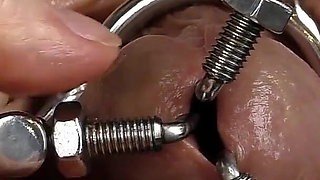 Dilation of the Hole Expanded Glans and Sperm Blockage Through Urethral Insertion of the Finger - Closeup