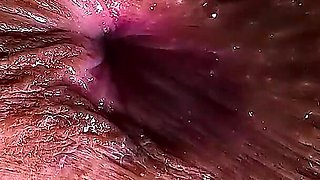 Indian College Girl Was Home Alone Had Accident Asshole Closeup Film with Her Boyfriend