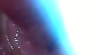 Endoscope POV: Test Tube Cock Urethral Insertion