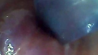 Endoscope POV: Test Tube Cock Urethral Insertion