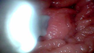 First Time: an Endoscope Reveals the G-spot up Close - Without Mounting!