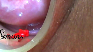 This Is What My Cervix Looks Like After a Year Without Seeing It.