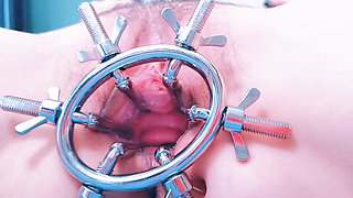 Speculum