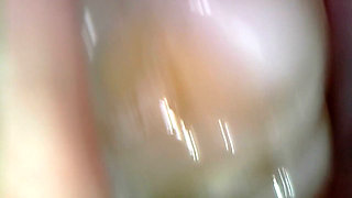 Medical Endoscope Oral Exam: Gummy Chewing, Extreme Teeth & Tongue Macro