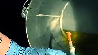 POV Patient. Sounding and Placing a Catheter