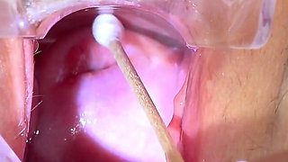 Super Cute Redhead Kaira Love Gets Her Cervix Examined with Speculum