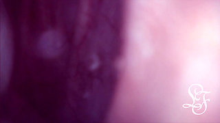 Bulge INSIDE my Bladder from Anal