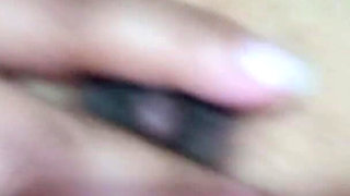 Nipples